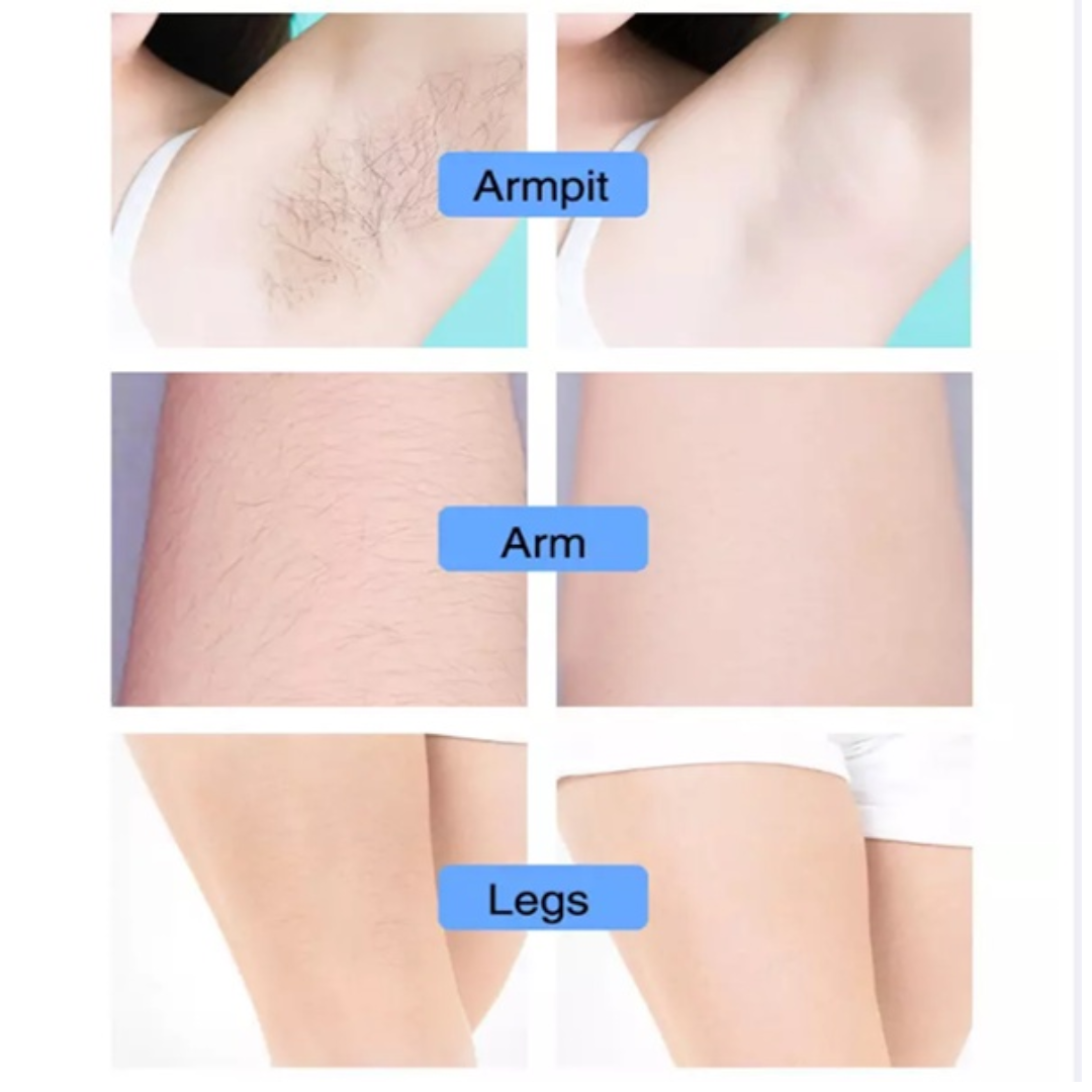Hair removal spray