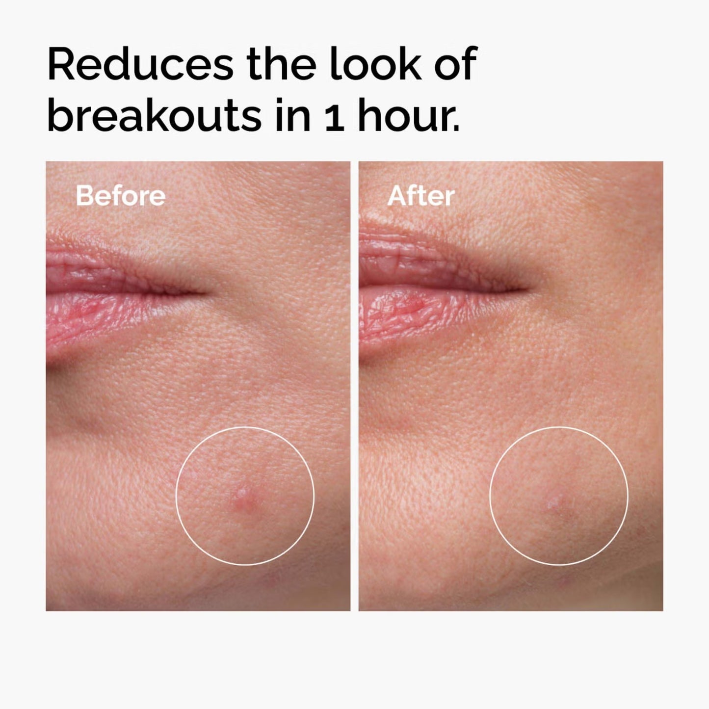 The Ordinary Sulfur 10% Powder-to-Cream Concentrate - 5g
